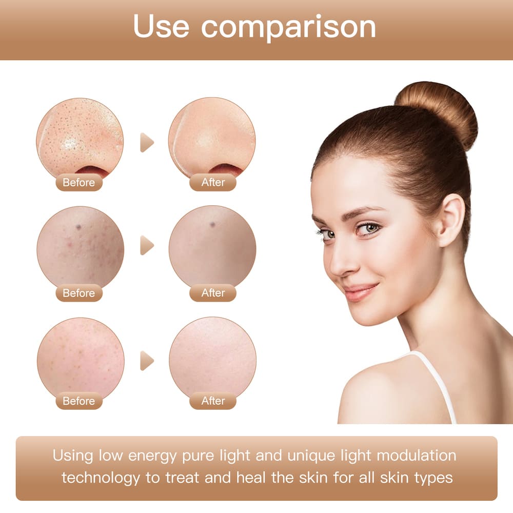 beauty gezichtsmasker met fotonentherapie tegen rimpels voor het gezicht
