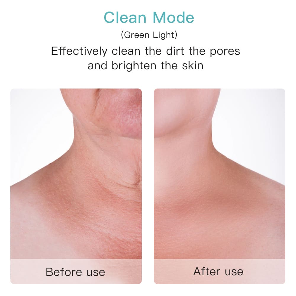 Effectieve poriënreiniger op het gezicht of de hals voor en na
